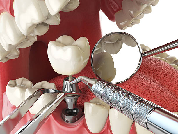 Best Emergency Root Canal Treatment in Luxora, AR
